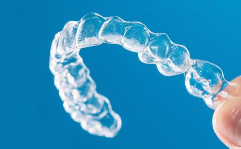 Ventajas de la ortodoncia invisible Invisalign