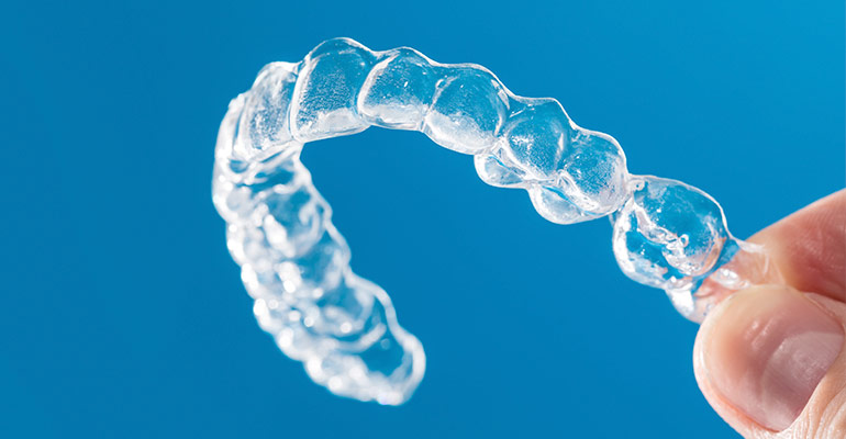 Ventajas de la ortodoncia invisible Invisalign