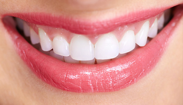 Sonrisa con implantes dentales