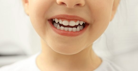 Policlínica Dental Stoma – Manchas en los dientes de los niños
