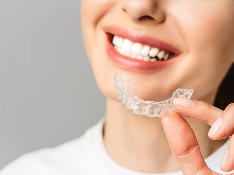 ¿Qué son los aparatos removibles de ortodoncia?